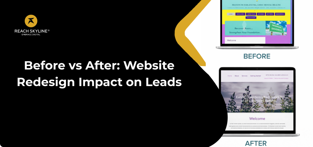 Before vs After: Website Redesign Impact on Leads